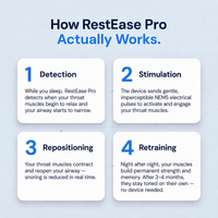 RestEase — Stop Snoring at the Source — 3